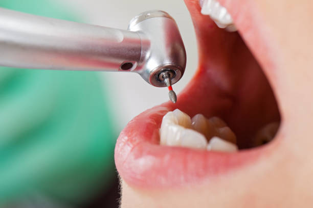 Best Emergency Dental Care for Broken or Chipped Teeth in Niagara, WI